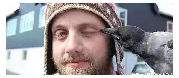 世界上最罕见人（世界上最罕见的病）