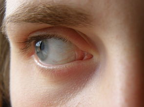 世界上最标准的眼,最标准的眼睛